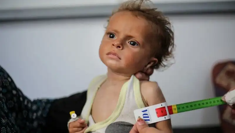 İngiltere, 300 Gazzeli Çocuğa Gelecek Sunacak Kapılarını Açıyor